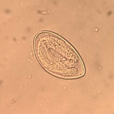 Enterobius vermicularis
