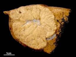 abdominal imaging for nonspecific RUQ