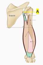 . Infraglenoid tubercle of scapula