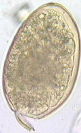 egg from a parasitic fluke