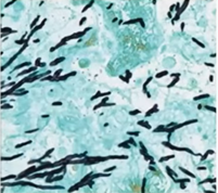 Aspergillus fumigatus 