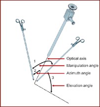 Manipulation angle