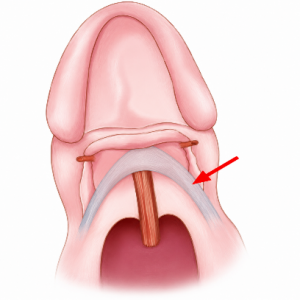 Eustachian tube